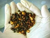 حصى المرارة البقرية تتجاوز الذهب سعرا فى الأسواق العالمية