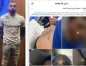 خناقة أولوية مرور تنتهي بجرح قطعي في وجه طالب.. والأمن يضبط المتهم بالساحل