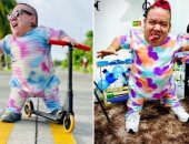 وفاة انفلونسر كولومبى تشعل السوشيال ميديا بسبب إصابته باضطراب نمو العظام