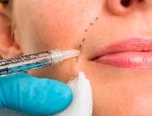 نص ملِ.. حكاية تريند تجميل أشعل السوشيال ميديا قبل العيد