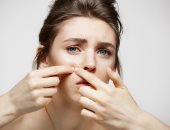 4 وصفات طبيعية للتخلص من البثور قبل مناسباتك المهمة.. الثوم كلمة السر