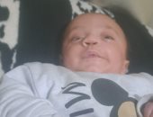 الرضيع علاء أبو طه بين أنف بفتحة واحدة وعينين فاقدتين للبصر..مأساة صحية لطفل فلسطيني تهدد حياته كل يوم بعد انهيار المستشفيات ونقص العلاج.. والده: كل يوم يمضي يهدد بصره ونحتاج علاجا عاجلا خارج غزة 