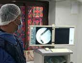 فريق طبى بحميات قنا ينقذ مريض من انسداد حاد بالقنوات المرارية