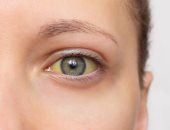 للأشخاص فوق 60 عاما.. هذه العلامة قد تدل على الإصابة بسرطان البنكرياس