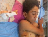 طفل فلسطينى يواجه مصيرا مجهولا وصرخة عاجلة لإنقاذه من قلب غزة