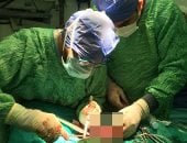 إجراء جراحة عاجلة لرضيع عمره 8 أيام مصاب بثقب فى المعدة بمستشفى طنطا العام