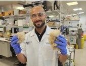 بقيادة باحث مصرى.. تجربة بريطانية تحول الصوف إلى مادة لإصلاح العظام