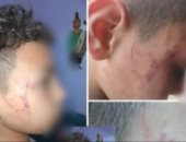 سبّها أمام زملائه فضربته.. كواليس إصابة طالب بخناقة مع معلمته بسوهاج