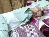 بين أصوات القصف وأنين الألم.. إيمان الهسي طفلة فلسطينية تواجه الموت البطيء داخل غزة.. ورم خبيث ينهش بطنها وجسدها الهزيل.. والدتها: لا يوجد علاج لها داخل القطاع والأطباء أكدوا ضرورة علاجها بالخارج لإنقاذ حياتها