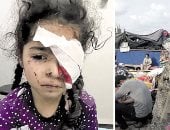 ظلام قسرى.. المئات يفقدون أبصارهم نتيجة القصف بالأسلحة المحرمة دوليا فى غزة.. 1500 فلسطينى فقدوا البصر بسبب الحرب.. 4000 آخرون مهددون بالعمى فى ظل نقص الأدوية.. وطفلة: ضاع حلمى بأن أكون معلمة