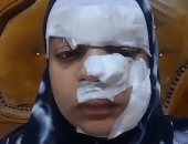 زوج يمزق وجه ويد زوجته بسبب دعوى خلع بالغربية