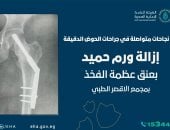 نجاح فريق العظام بمجمع الأقصر الطبى فى استئصال ورم حميد لسيدة فى الثلاثينات