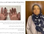 ضبط بائعة جائلة أجنبية قطعت صابع أخرى بسبب الأطفال