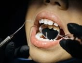 حالة تصيب أسنان ملايين الأطفال تتسبب فى ضعفها وتسوسها.. ما هي وكيف تحدث؟