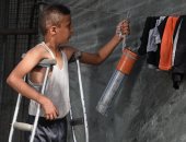 طفل فلسطينى يستعين بـ"ماسورة" لتعويض قدمه المبتورة بسبب القصف الإسرائيلى