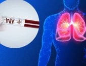 أول عملية زرع رئة فى العالم بين شخصين مصابين بـ الإيدز