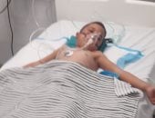 معاناة صحية للطفل الفلسطيني أحمد القاضي في غزة.. جسد صغير يذوب تحت وطأة مرض نادر أفقده شقيقيه.. طفولة مسروقة بين الألم والمستشفيات.. ونداء أم مكسورة القلب تتوسل الحياة لابنها قبل أن تلحقه نفس النهاية.. صور