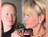 شبيهة هالاند.. الروسية أناستاسيا حيرت العالم بسؤال: هو ده هالاند ولا أخته؟
