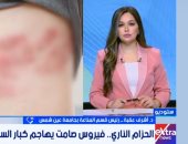 احذر الحزام الناري.. طبيب يوضح الأعراض والفئات الأكثر عرضة.. فيديو