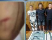 ضبط المتهمين بالتعدي بسلاح على صديقهم بسبب المزاح.. فيديو