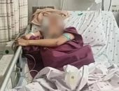 صينية تنجو من السقوط من الطابق 18 بعد قفزها إثر خلاف مع صديقها
