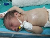 "قلب صغير يصارع من أجل الحياة فى غزة".. الرضيع يحيى أبو طعيمة 21 يوما فقط يواجه تشوهات قلبية معقدة ويحتاج لجراحة عاجلة خارج القطاع.. ووالدته تناشد:"فقدت ابنا من قبل وربنا عوضني بيحيى.. أنقذوه قبل فوات الأوان"