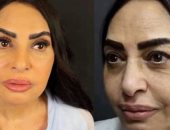سلوى خطاب بعد عملية شد الوجه: كان عندى تكتلات دهنية فى وشى وشلتها