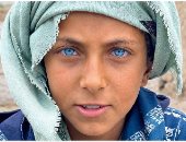 عينان زرقاوان تغيّران حياة طفل يمني.. شاهد القصة