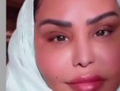 أحلام تظهر بإطلالة جديدة وتثير تفاعل جمهورها بعد تغيير وجهها 