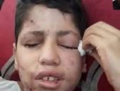 صرخة أم في العتمة.. إبراهيم أبو شاب فقد بصره وبُترت أصابع يده وأصيب بحروق وشظايا مزقت جسده في انفجار خلال الحرب على غزة.. 6 أشهر من الانتظار لتحويلته الطبية والأمل الأخير لعودة النظر من جديد