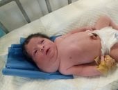 خطر يهدد حياة الرضيع ناصر الخطيب.. كيس لمفاوي في رقبته يضغط على القصبة الهوائية ويعيق تنفسه ورضاعته ويخفض مستوى الأكسجين.. وأسرته تناشد الجهات المختصة إنقاذه وتمكينه من السفر للعلاج خارج قطاع غزة
