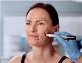 مخاطر البدء مبكرا.. جراح تجميل يكشف العمر المناسب لإجراء عملية شد الوجه