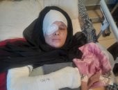 من تحت ركام ميناء الصيادين في غزة.. دينا مقداد تروي شهادة صمود بين بتر الأطراف وجراح الرأس.. فقدت زوجها ونصف وجهها بقصف إسرائيلي.. ترقد في مجمع الشفاء بين جراح المخ وبتر اليد.. وتستغيث لمنحها أمل العلاج بالخارج