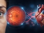 5 علامات تظهر على العين تشير إلى مشاكل فى القلب