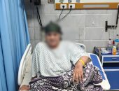 لدغتها الطريشة فى منزلها.. 50 جرعة مصل تنقذ حياة سيدة بمستشفى الزقازيق العام