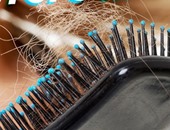 أمراض خطيرة وراء تساقط الشعر أهمها الأنيميا واضطرابات الغدد