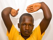 بالصور.. جراحة نادرة لشاب أفريقى كى يستطيع إنزال ذراعيه من فوق رأسه