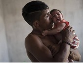 منظمة الصحة العالمية:زيكا يكشف "عجز"بعض البلدان المتضررة بأمريكا اللاتينية