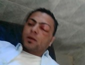 شاب مصاب بحادث يحرر محضر ضد طبيب بالفرافرة رفض اسعافه