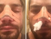 بالفيديو .. تربل اتش يكسر أنف رومان رينز ويعرضه لعملية جراحية