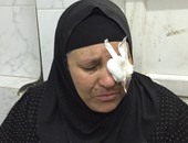 ضحية إهمال رمد طنطا: "الممرضة قالت لى ده عيب حقنة وادعى ربنا يشفيكى"
