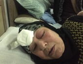 ضحية رمد طنطا : بعد الحقن ظهر خراج وصديد فى عينى والمستشفى رفضت استقبالى