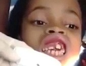 بالفيديو.. طبيب أسنان يعثر عن 15 دودة داخل فم طفلة برازيلية