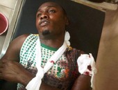 بالصور.. إصابة "5" لاعبين فى هجوم مسلح على كانو بيلارز النيجيرى