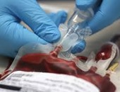 إدارة الغذاء والدواء الأمريكية توصى بفحص أكياس دم التبرع للكشف عن زيكا 