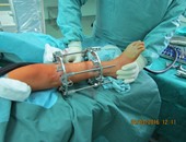 بالصور.. قافلة الأزهر تجرى عمليات جراحية داخل أكبر مستشفى جامعى فى البوسنة