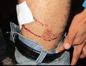 ماذا تفعل لو...؟ لديك مصاب ينزف من جرح فى جسمه؟