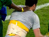 طبيب البرازيل ينفى ارتداء سيزار "دعامة معدنية"