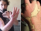 بالصور.. رجل يحول شامة ضخمة على يده إلى خريطة