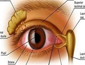 وصفة طبيعية تحسن الرؤية وتساعد فى علاج قصر النظر